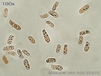 Duinwasplaat